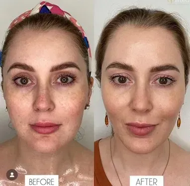 Side-by-side comparison: woman's face
