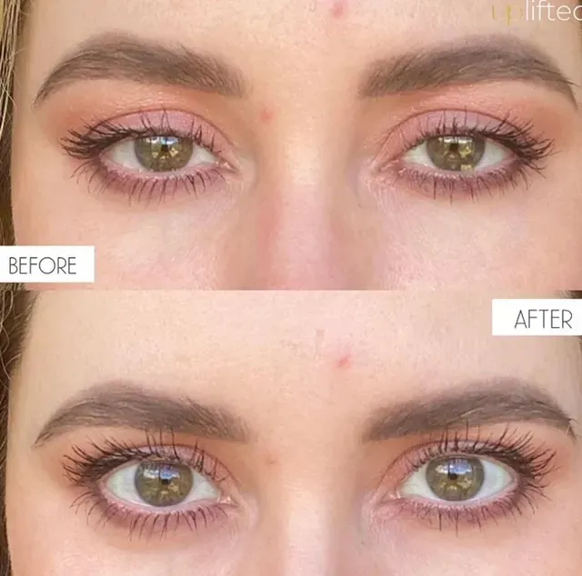 Comparison of eyes before and after cosmetic lash lift.