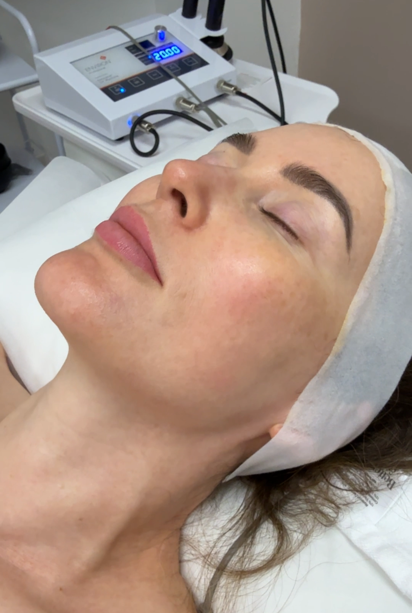 Woman having a facial treatment at Uplifted Aesthetics, in Redondo Beach, , lying on a treatment bed in a clinic setting.