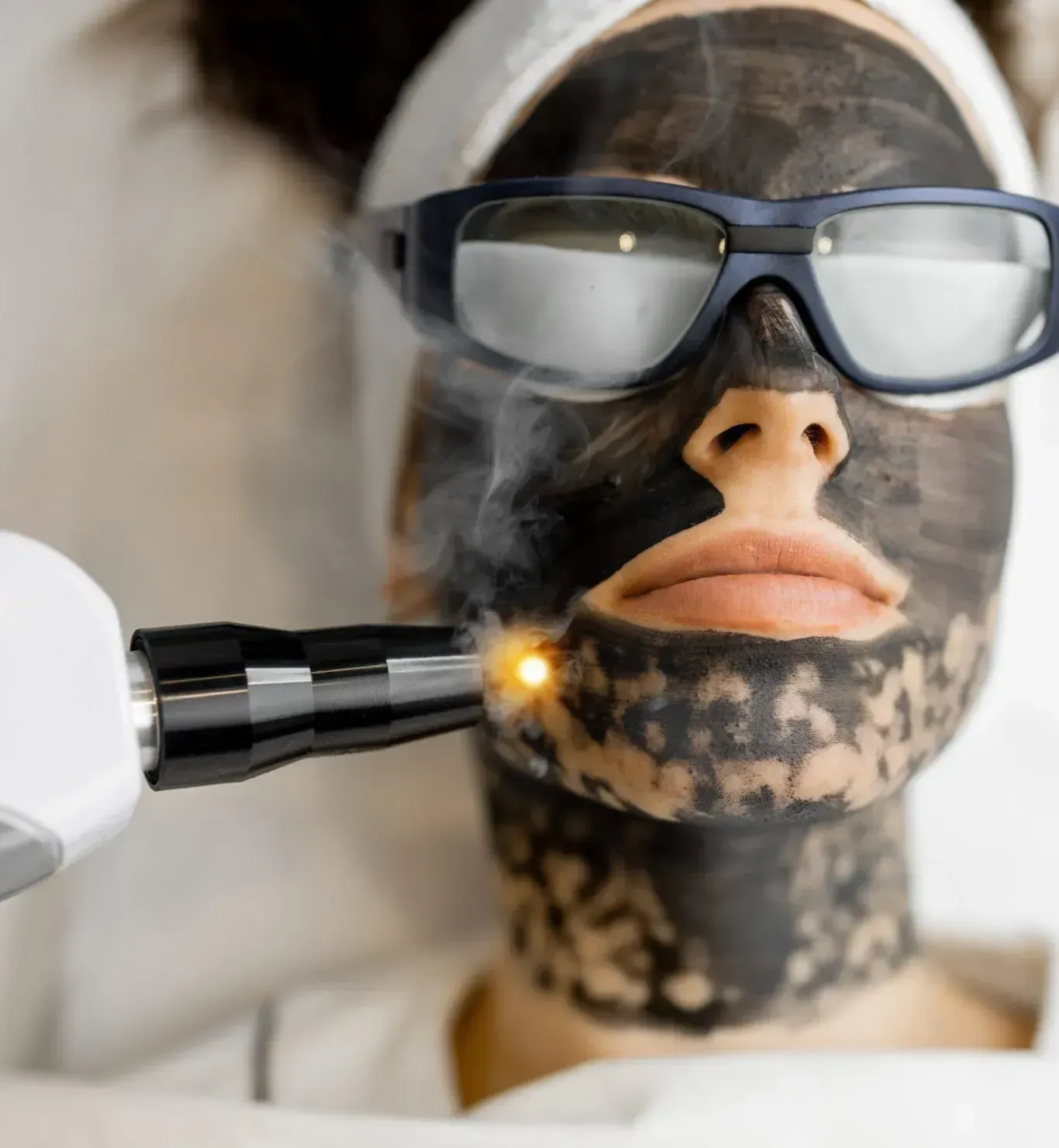 Person undergoing carbon laser facial treatment; a laser device is pointed at their face with black carbon mask.