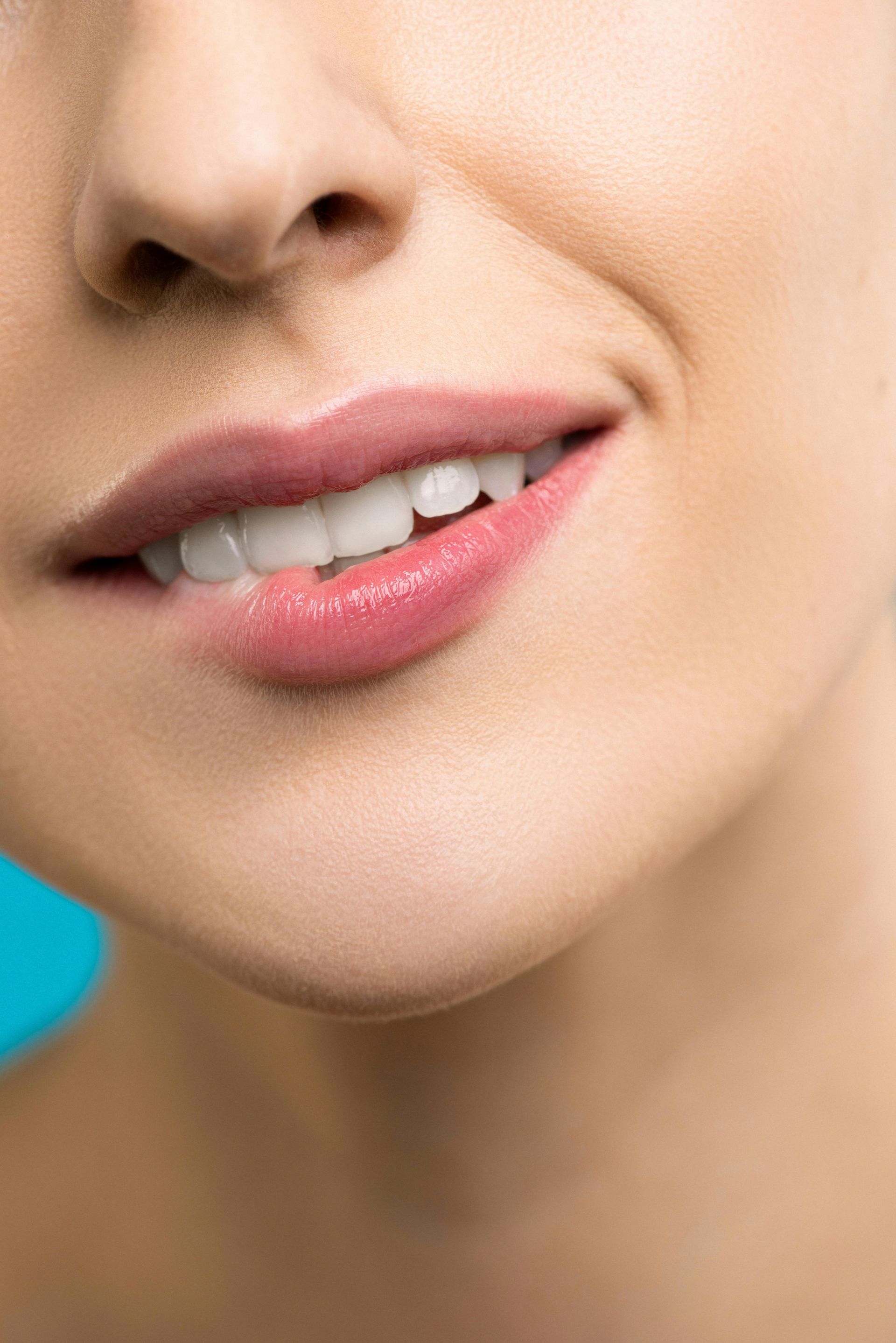 Precise lip filler application at Uplifted Aesthetics in Redondo Beach showing anatomical placement 