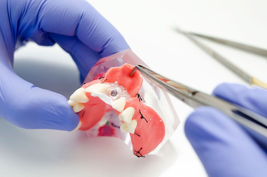 ESCUELA TÉCNICA DE PRÓTESIS DENTAL