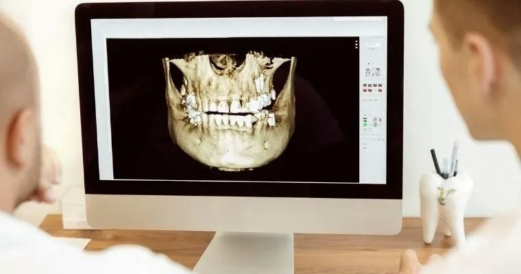 Dental Implants Westport and Ridgefield, CT