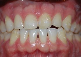 Smile Gallery