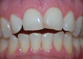 Smile Gallery