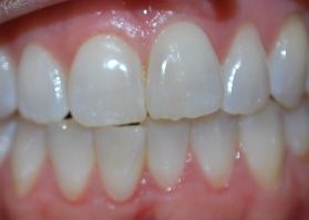 Smile Gallery