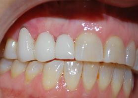 Smile Gallery