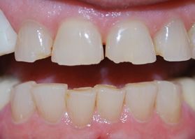 Smile Gallery