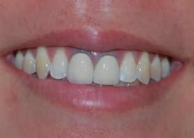 Smile Gallery
