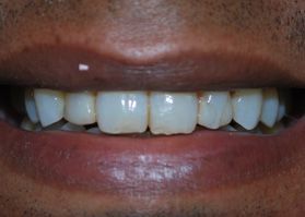 Smile Gallery