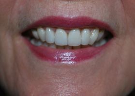 Smile Gallery