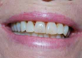 Smile Gallery