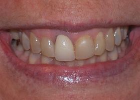 Smile Gallery