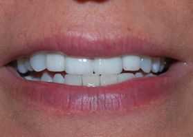 Smile Gallery