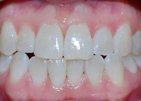 Smile Gallery