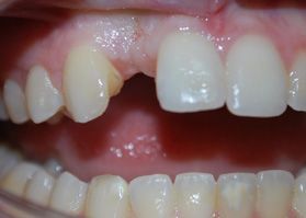 Smile Gallery