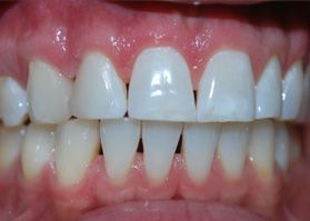 Smile Gallery