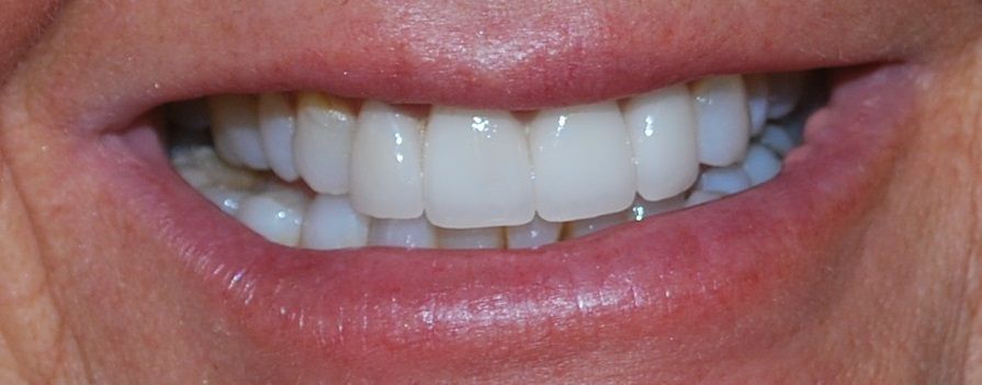 Smile Gallery