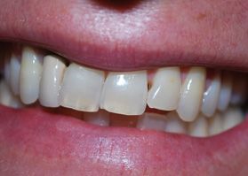 Smile Gallery