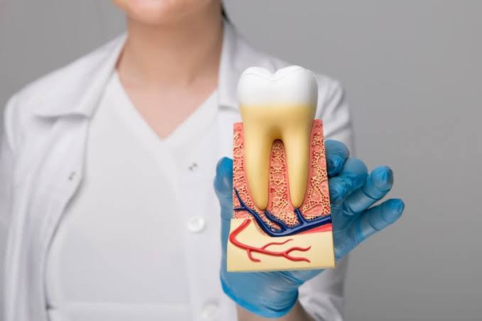root canal treatment in Westport