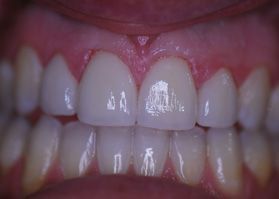 Smile Gallery