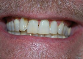 Smile Gallery