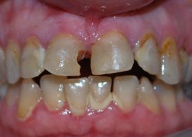 Smile Gallery