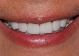 Smile Gallery