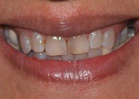 Smile Gallery