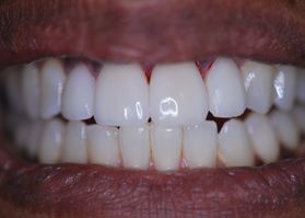 Smile Gallery
