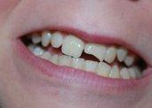 Smile Gallery