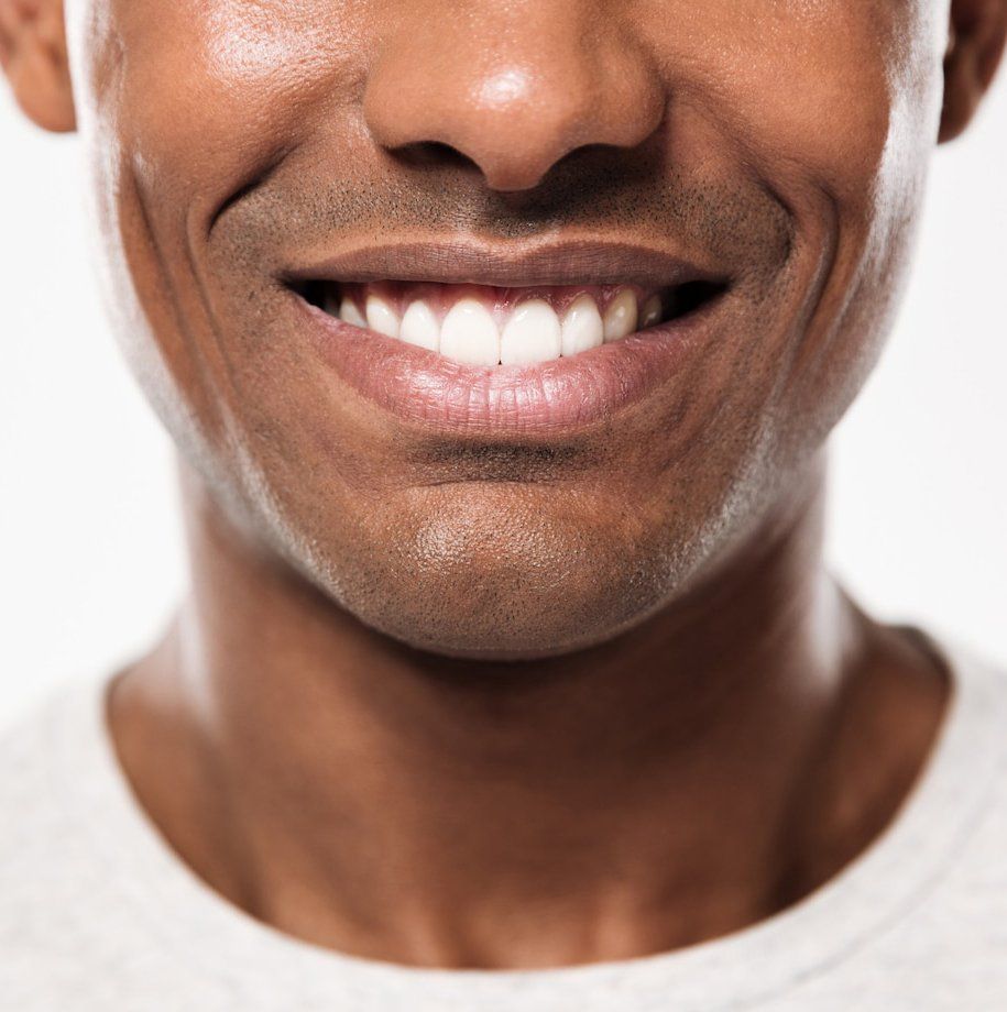 Porcelain Crowns