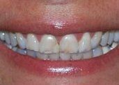 Smile Gallery