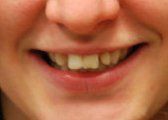 Smile Gallery