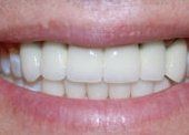 Smile Gallery