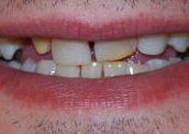 Smile Gallery