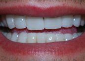 Smile Gallery