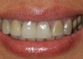 Smile Gallery