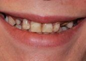 Smile Gallery