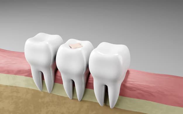 Dental Onlays in Westport