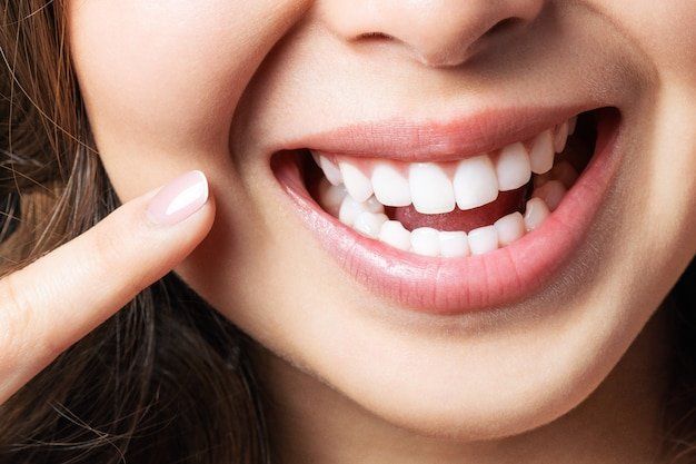 Dental Implant