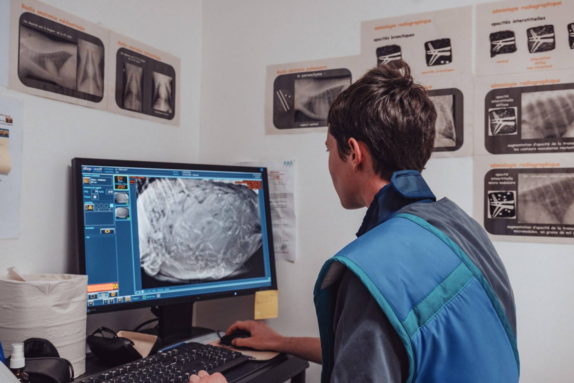 Une personne en gilet bleu analyse une image médicale sur un ordinateur dans un cabinet médical.
