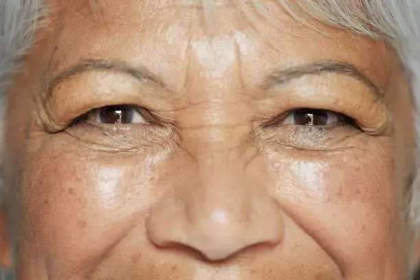 A close up of an elderly woman 's eyes and nose.