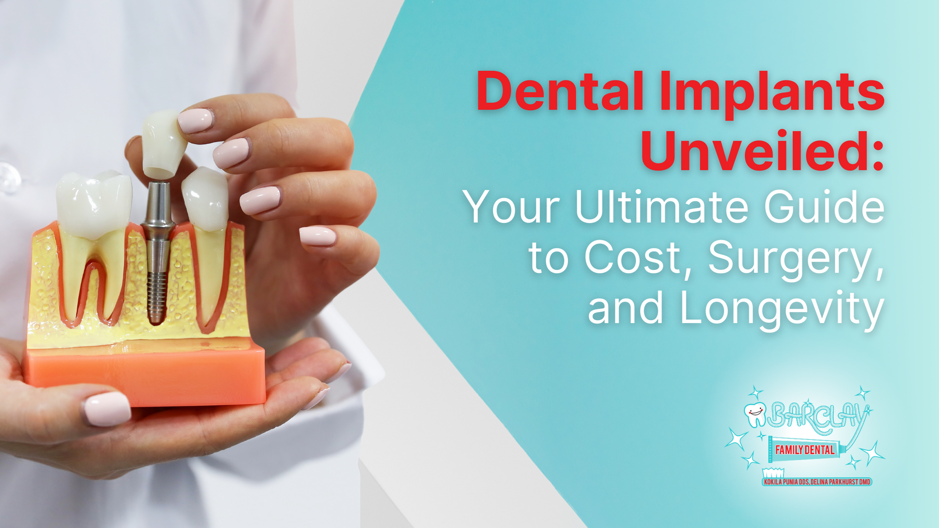 Ultimate Guide IMPLANTS 【公式通販】