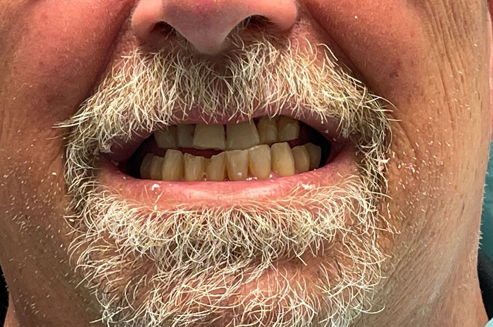 Close-up of a person's open mouth, showing yellowish teeth and a gray beard.