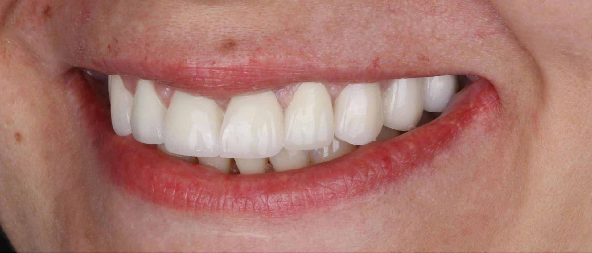 A close up of a woman 's smile with white teeth and red lips.