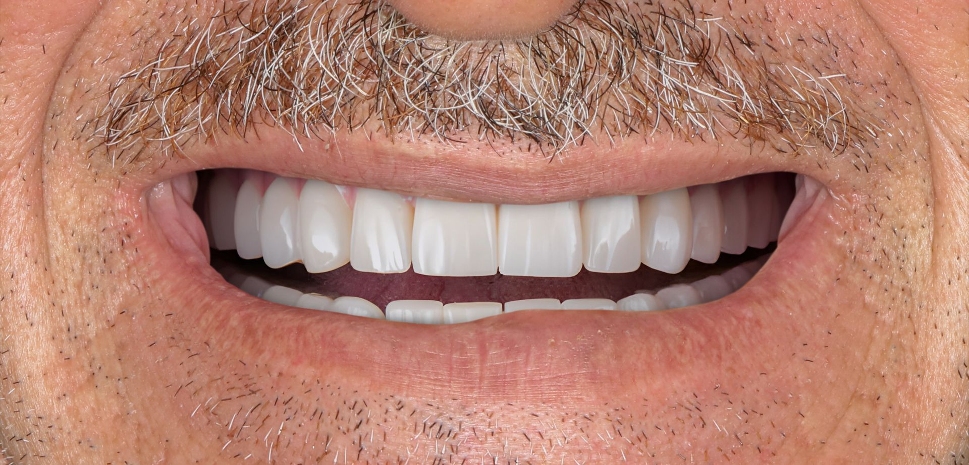 A close up of a man 's mouth with a beard and white teeth.