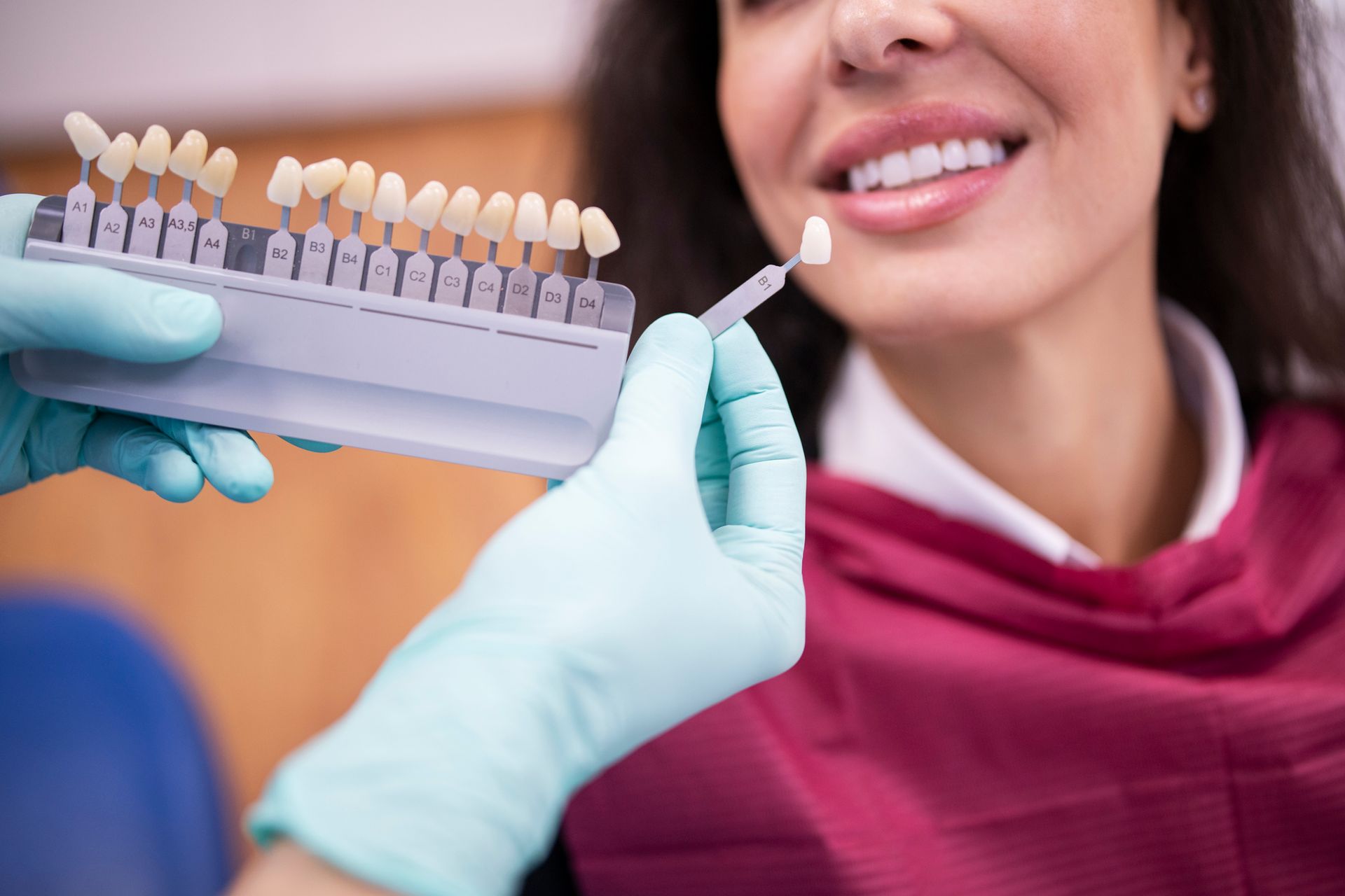 Dentist matching the right white tone for dental veneers.