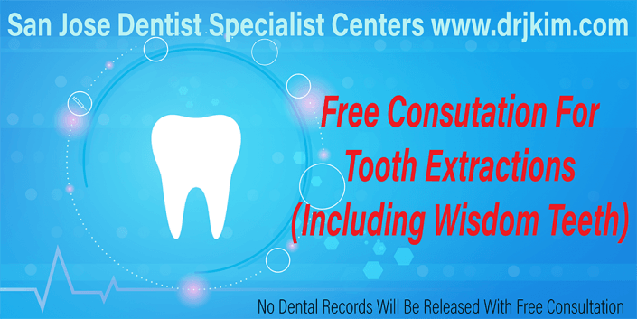 Free Consultation For Extraction