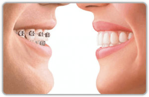 Beautiful Smile Front Of Each Other